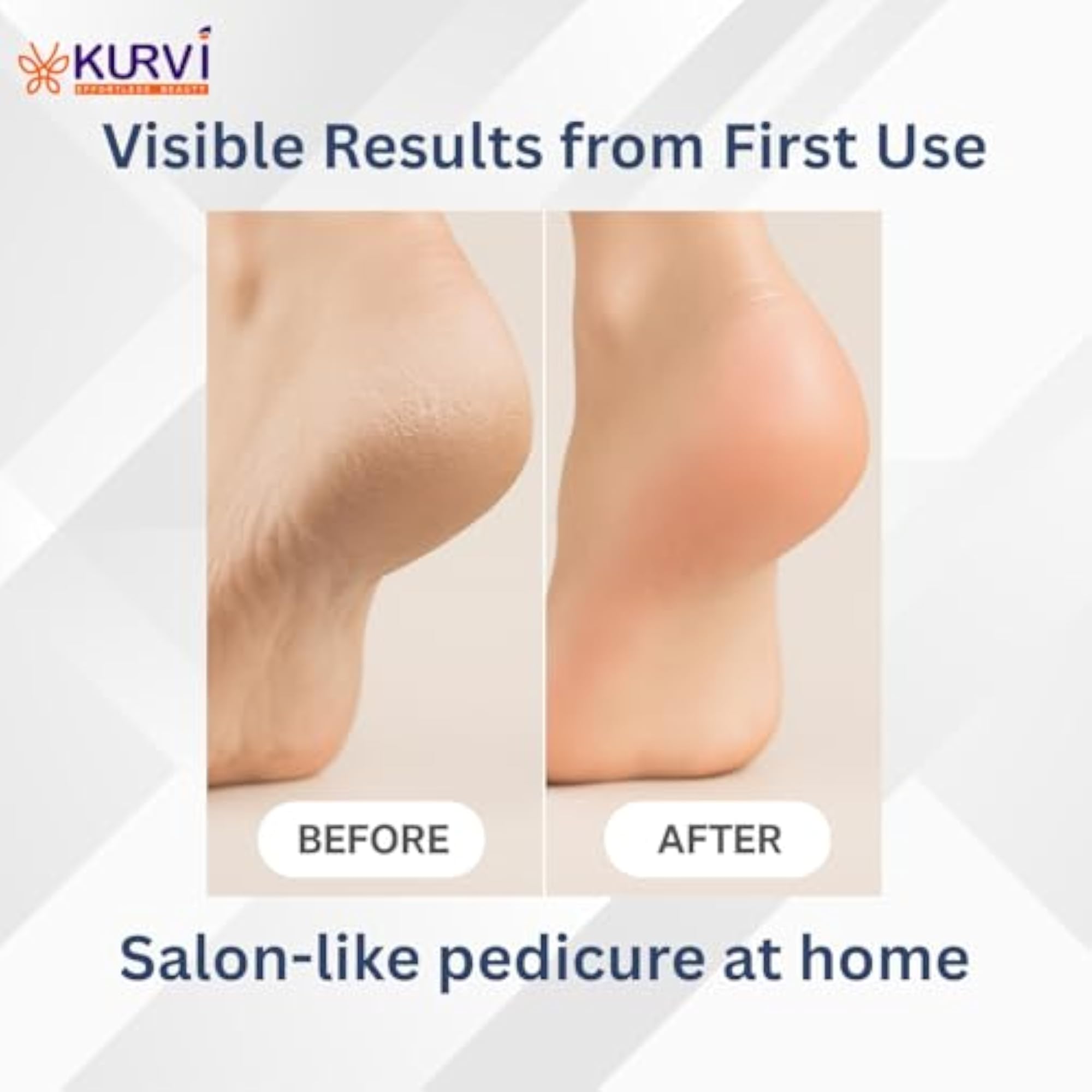 Foot Scrubber for Dead Skin, Pedicure Tools for Feet